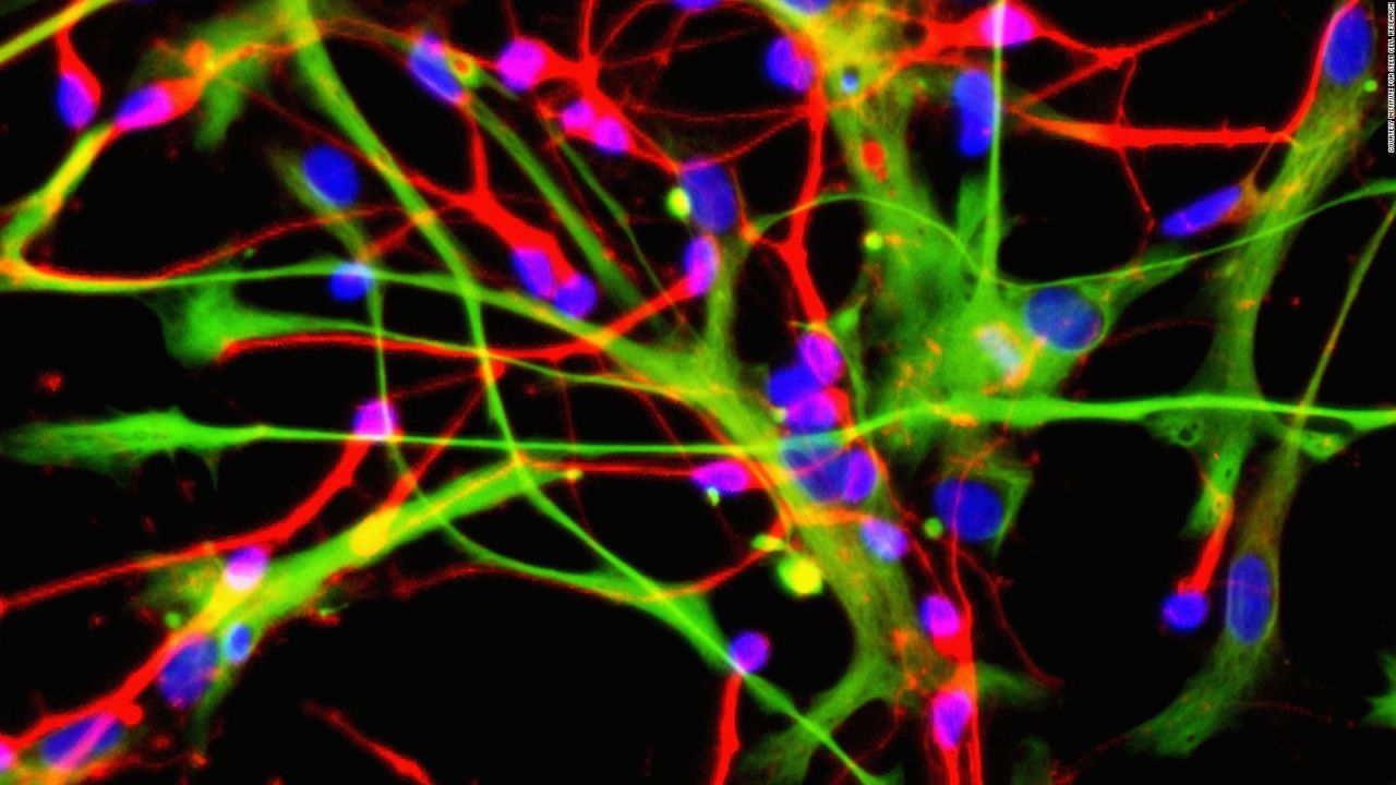 CNNE 822297 - el proceso que convierte a las celulas madre en neuronas