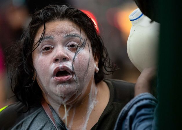Varios manifestantes tuvieron que echarse leche luego de estar expuestos a granadas de percusión y gases lacrimógenos. Carlos González / AP