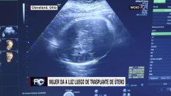 CNNE 864614 - cole, el bebe nacido de un utero trasplantado