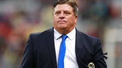 CNNE 867299 - ¿nuevos fichajes en el america? miguel herrera responde si sera posible