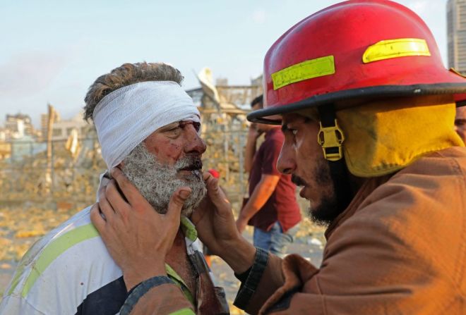 Un hombre herido es atendido por un bombero cerca de la escena de la explosión, en el puerto de Beirut.