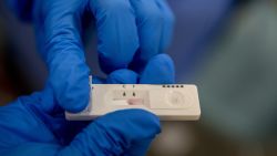 MADRID, SPAIN - SEPTEMBER 29:  A health care worker holds a rapid COVID-19 disease antigen test device at a temporary testing point in Vallecas neighborhood during the second wave of Coronavirus (COVID-19) pandemic on September 29, 2020 in Madrid, Spain. Certain areas of Madrid are back in lockdown, as one thousand free COVID-19 tests are carried out daily in an effort to curb the soaring cases. Residents are alerted by mobile phone messages of their appointed times, as 1 million tests are said to be conducted.