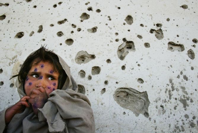 Mohboba, de 7 años, permanece cerca a un muro con balazos en Kabul, mientras espera que la atiendan en una clínica de salud en marzo de 2002. La niña sufría de una enfermedad en la piel que afectaba a muchos niños pobres de Afganistán.
