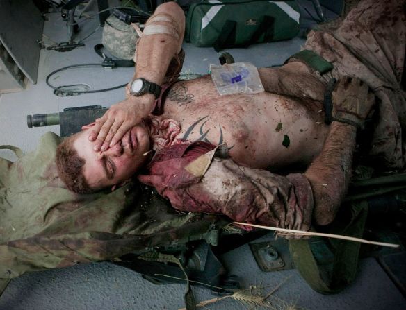El infante de marina de EE.UU. Burness Britt reacciona después de que lo subieran a un helicóptero de evacuación médica en junio de 2011. Un gran trozo de metralla de un artefacto explosivo improvisado cortó una arteria importante en su cuello cerca de Sangin, Afganistán. Esta foto la tomó Anja Niedringhaus, una fotógrafa de Associated Press que fue asesinada a tiros en Afganistán en 2014.