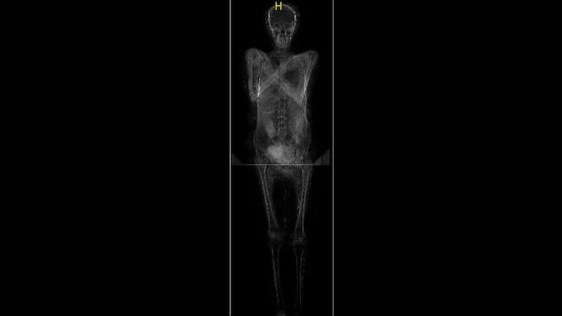 Se descubrió que el cuerpo tenía una "estructura esquelética delicada", lo que llevó a los investigadores a sospechar que era de una mujer.