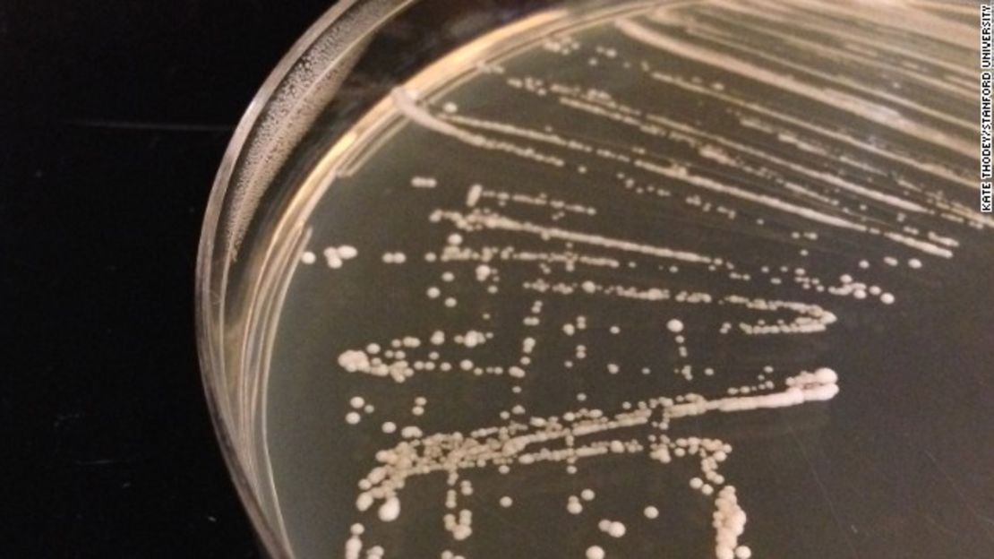 La levadura genéticamente modificada crece en una placa de Petri en el laboratorio de Smolke en la Universidad de Stanford.