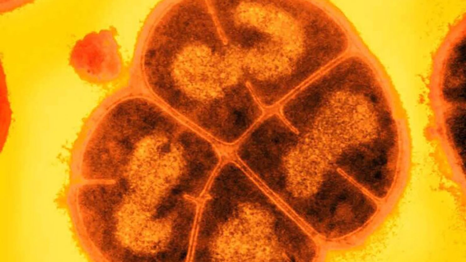 ‘Conan the Bacterium’ can withstand radiation that could kill a human. Scientists say they’ve found its secret weapon