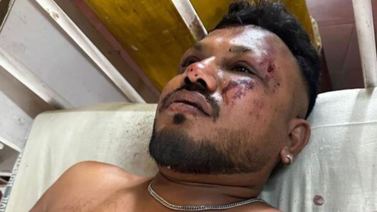 Vishwash Kumar Ramesh, reportado por los medios locales como un sobreviviente del accidente del vuelo 171 de Air India.