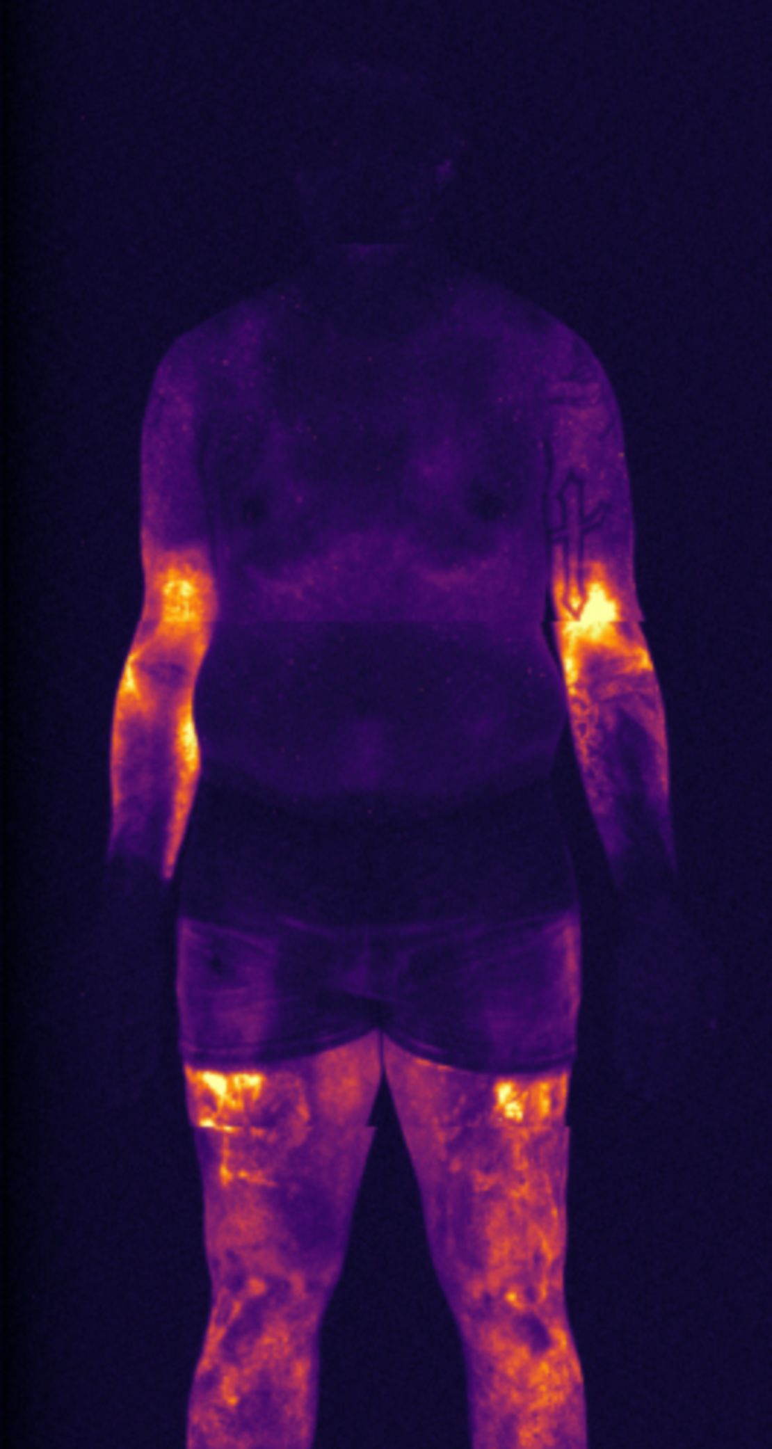 Skin contamination from particulate exposure with standard firefighting gear used by the California Department of Forestry and Fire Protection.