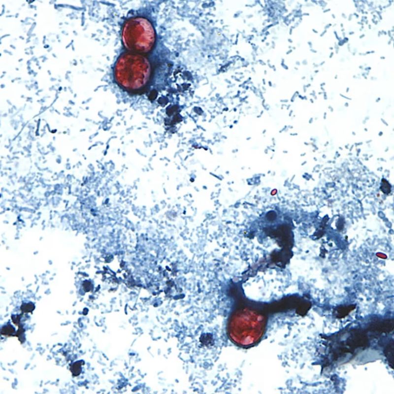 Autoridades de EE. UU. planean declarar el fin del mayor brote de ciclosporiasis por lechuga iceberg