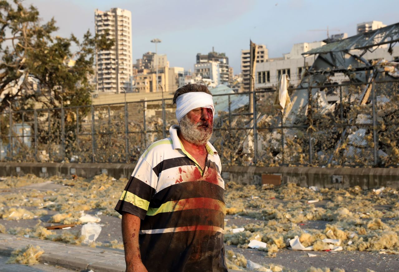 A wounded man walks near the scene of an explosion.