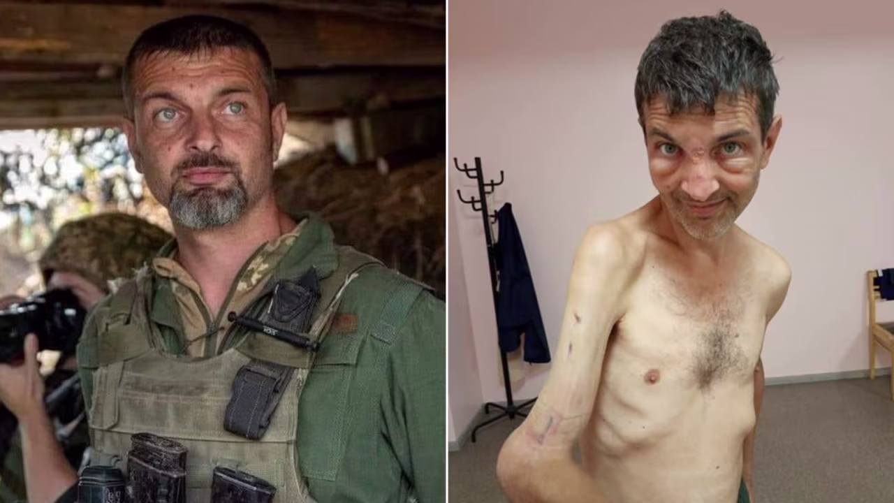 Ukrainian soldier Mykhailo Dianov before and after his time in Russian captivity. CNN is unable to independently verify the authenticity of these images.