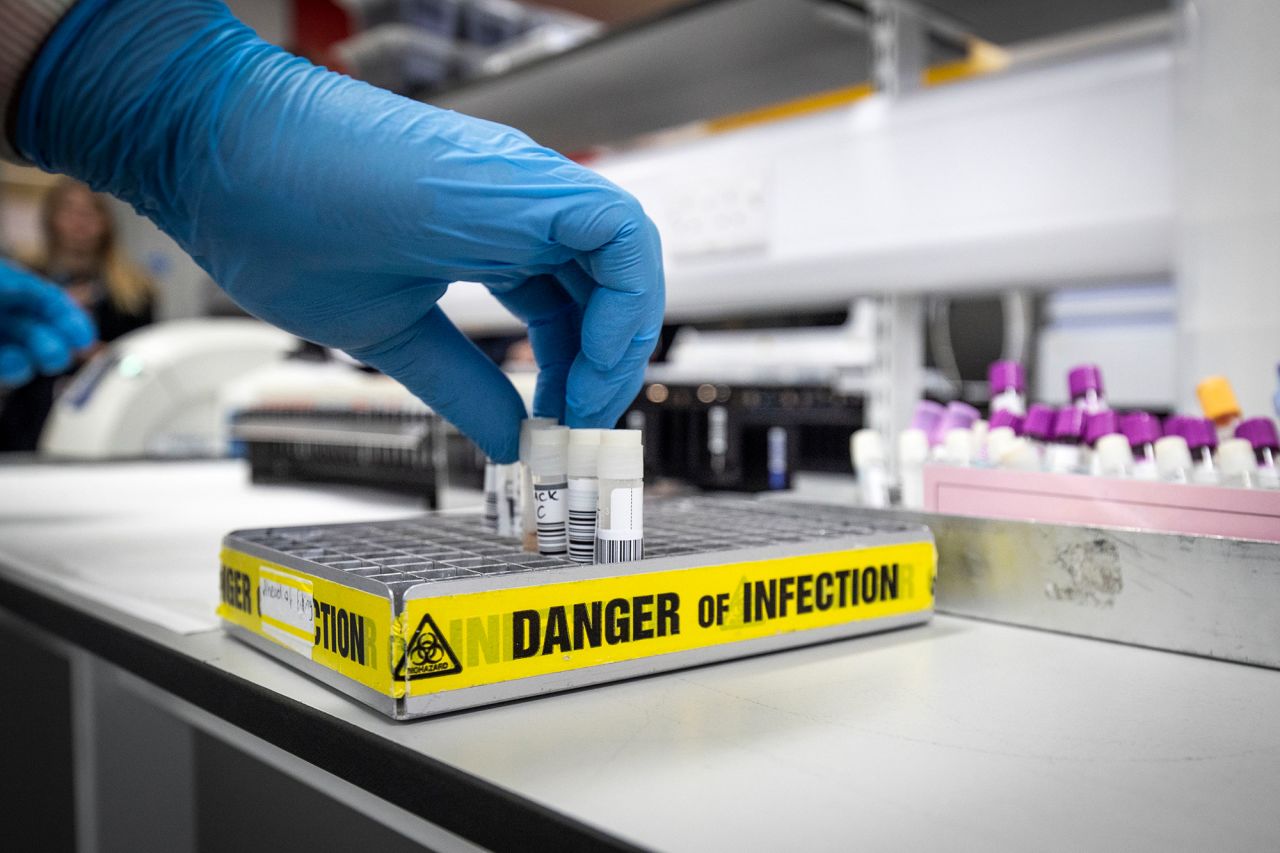 Clinical support technician Douglas Condie extracts viruses from swab samples so that the genetic structure of a virus can be analysed and identified in the coronavirus testing laboratory at Glasgow Royal Infirmary, on Wednesday, February 19, in Glasgow, Scotland.