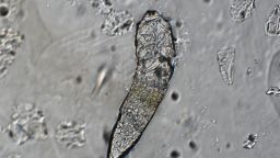 demodex-mite.jpg