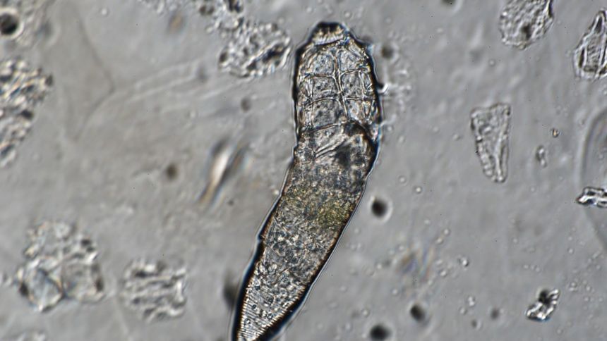 Demodex mites found in humans are usually 0.15 millimeters to 0.4 millimeters long, or less than the size of a pinpoint.