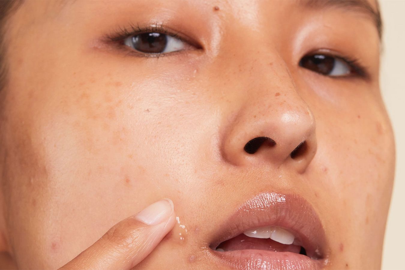 want to know more how to use spot treatment for oily skin