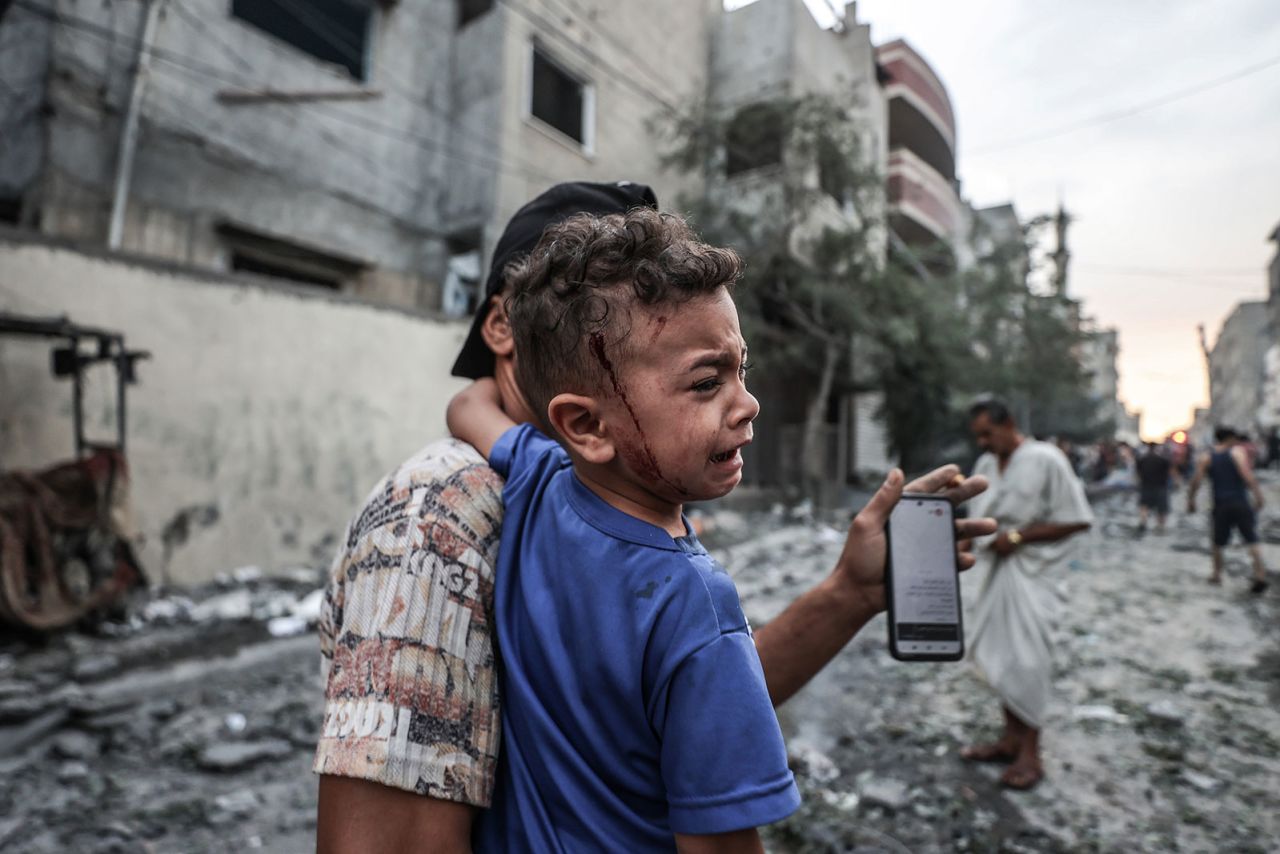 An injured Palestinian child is pictured in the aftermath of Israeli airstrikes at al-Shati refugee camp in Gaza on October 9. 