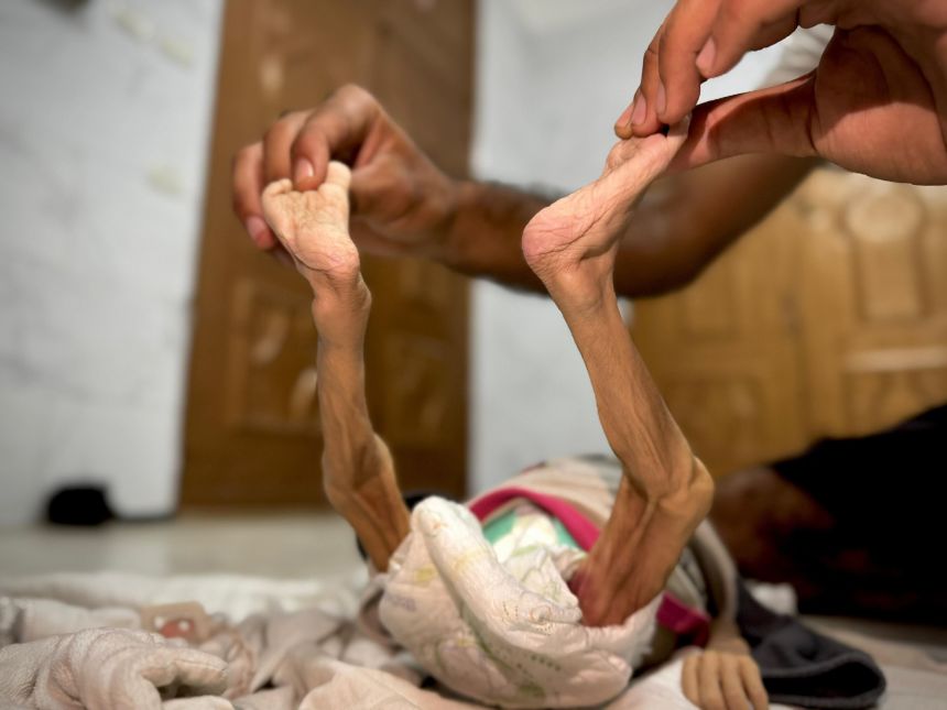 5-month-old child dies in mom’s palms in Gaza, a brand new sufferer of escalating hunger disaster | The Gentleman Report