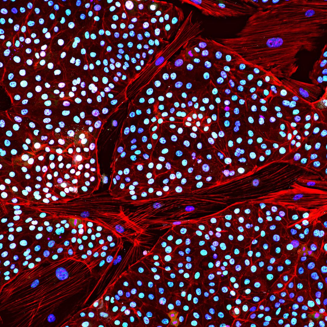 An Asian elephant stem cell line stained in different colors to highlight different elements.