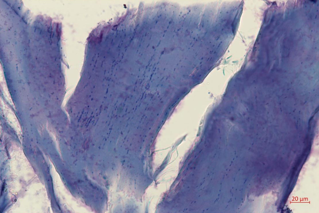 A microscope image of subdermal muscle from the ancient skin shows remnants of mammoth nuclei. The new study revealed that fossils of ancient chromosomes survive in this skin sample.