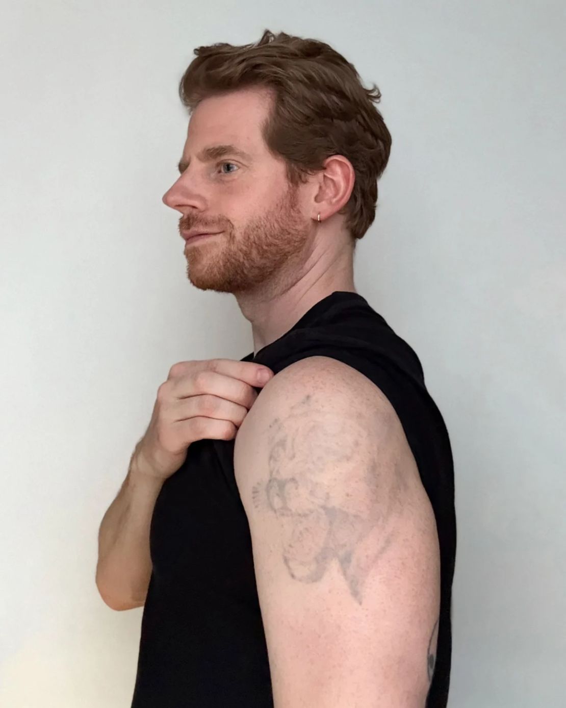 La cabeza de una pantera y varios otros tatuajes casi han desaparecido, dejando solo contornos descoloridos.