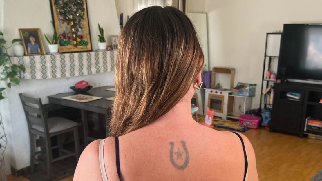 Se ha sometido a múltiples tratamientos con láser en tres tatuajes, pero aún no ha visto mucho progreso.