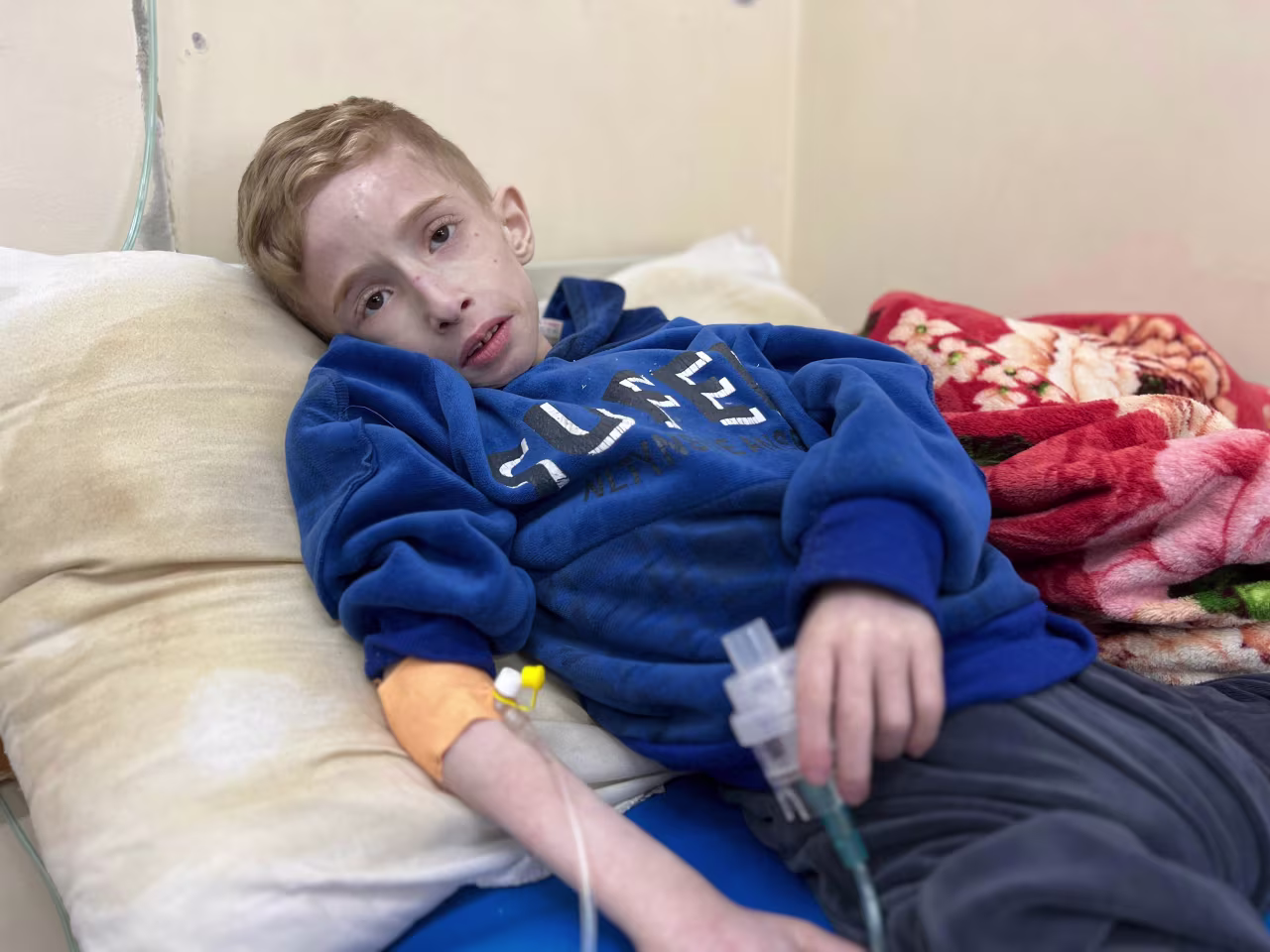 Six-year-old Fadi Al-Zanat is pictured on March 10 at Kamal Adwan Hospital in Beit Lahia, Gaza, where he is suffering from severe malnutrition and dehydration, according to the health ministry in the strip.