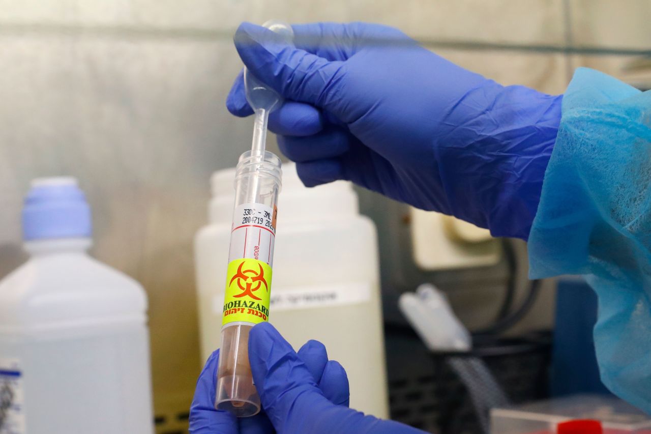 Israeli scientist Katya Levitski conducts tests on the coronavirus at the Tel Aviv Sourasky Medical Center, a segment of which will be dedicated to receiving patients suffering from coronavirus, on March 19, in Tel Aviv, Israel.