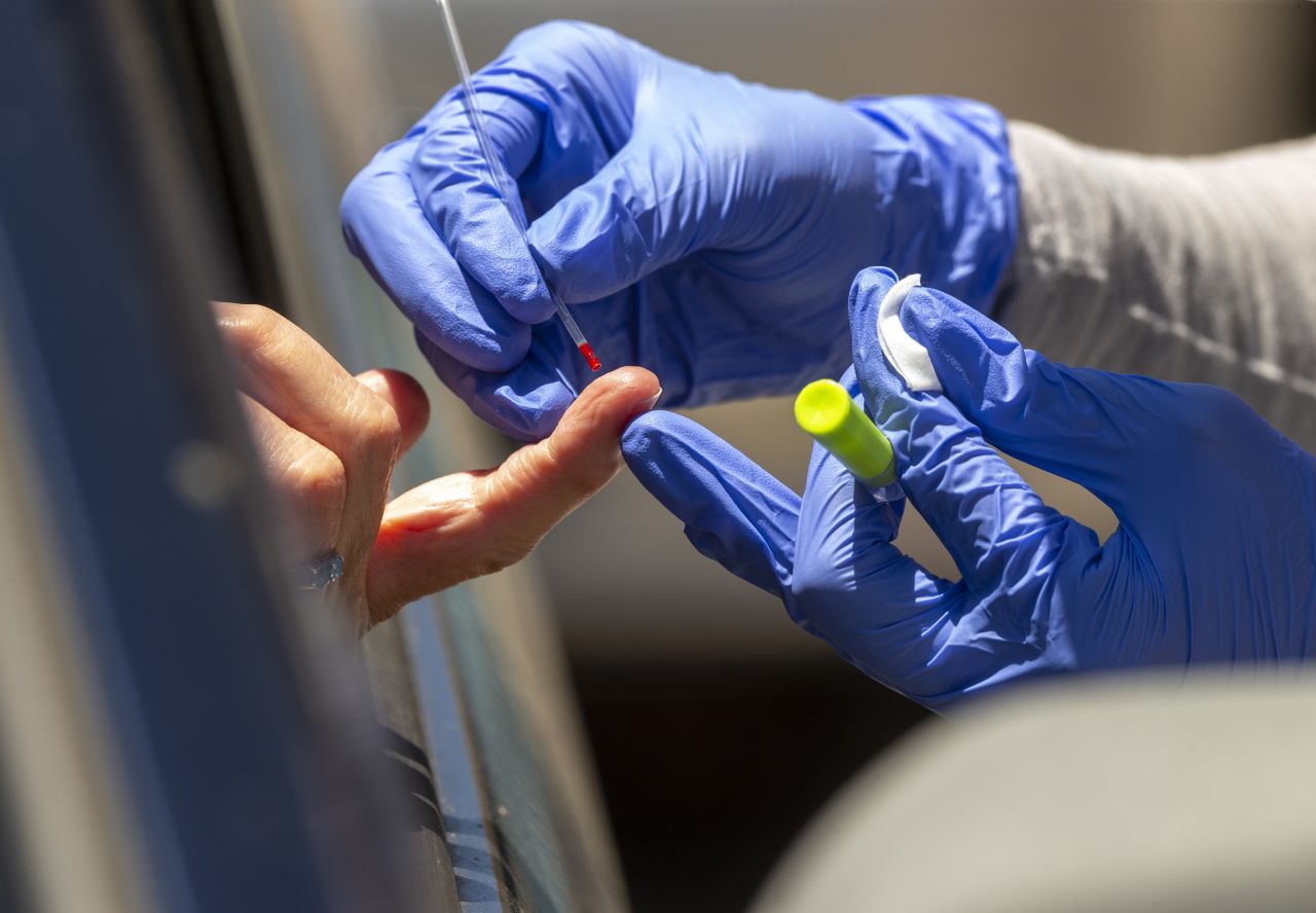 A member of myCovidMD performs a Covid-19 antibody test in Los Angeles on May 20.