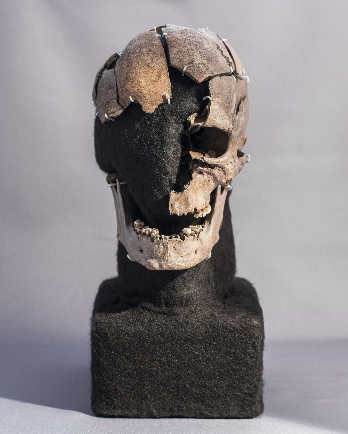 The fragmented skull of "Vittrup Man" is on display at Denmark's Vendsyssel Historical Museum.