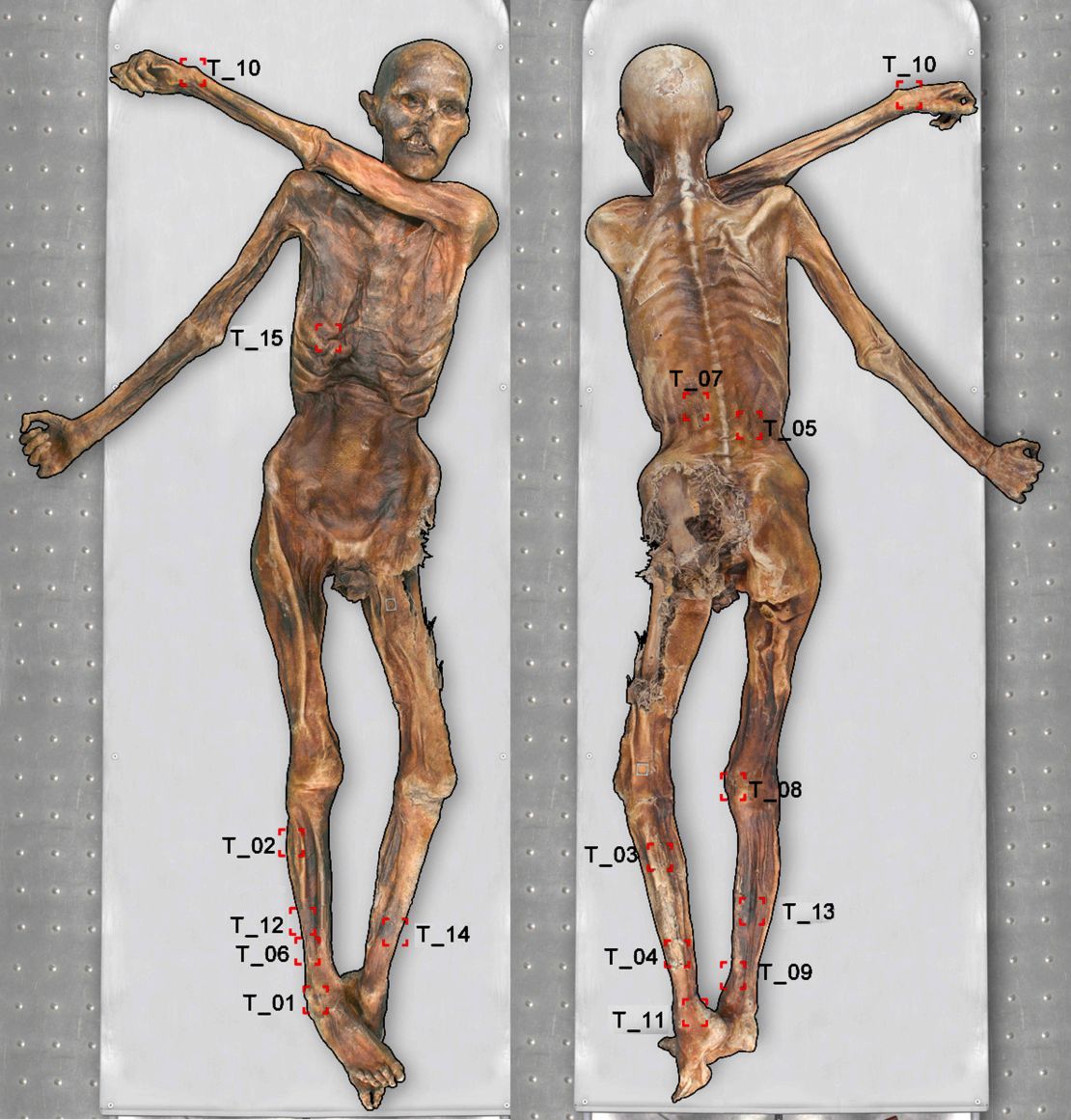 Ötzi had tattoos on several areas of his body.