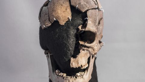 The cranial remains of Vittrup Man, who ended up in a bog after his skull had been crushed by at least eight heavy blows. 