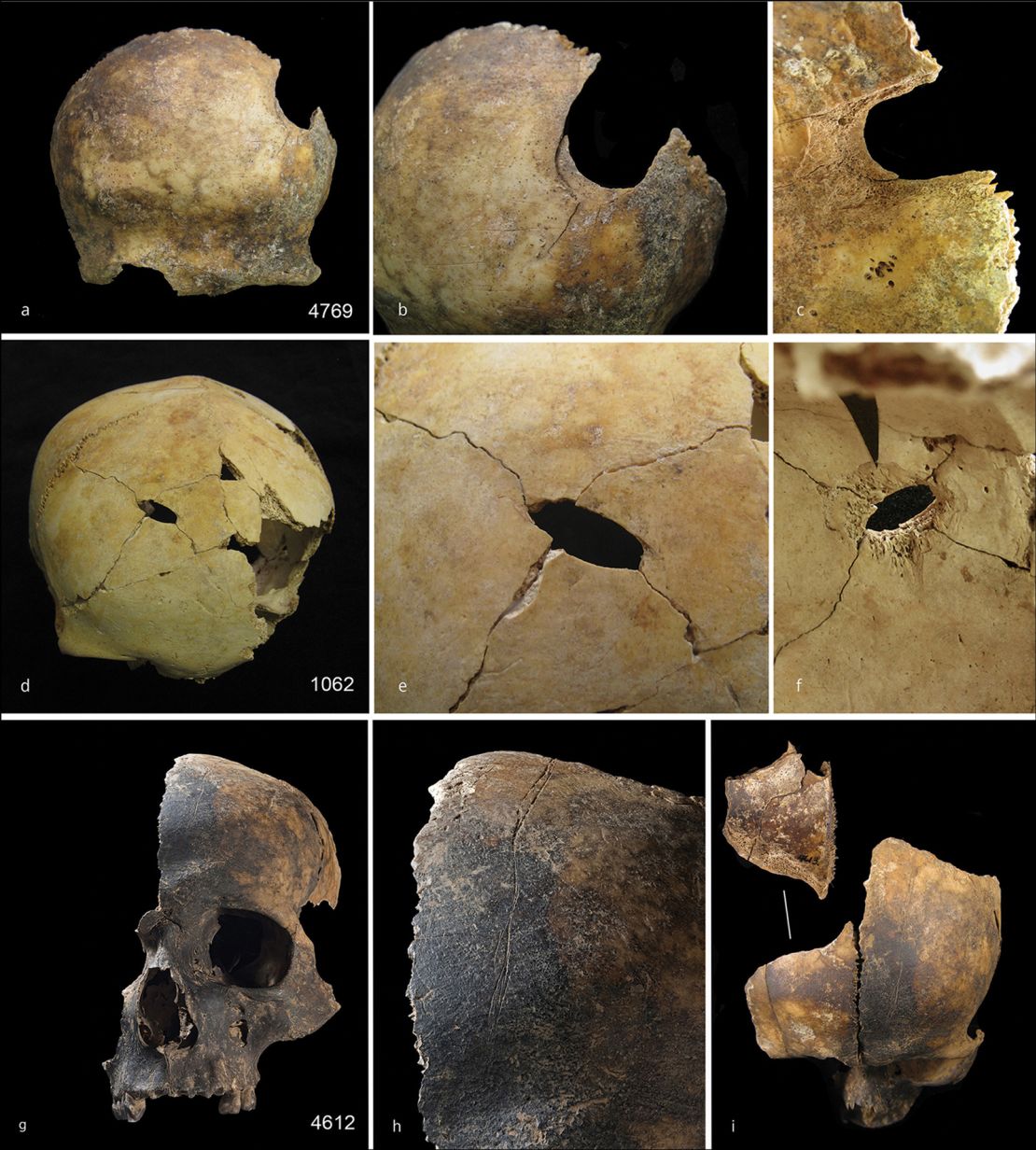 Multiple skulls from the site show where attackers dealt fatal blows to the victims.