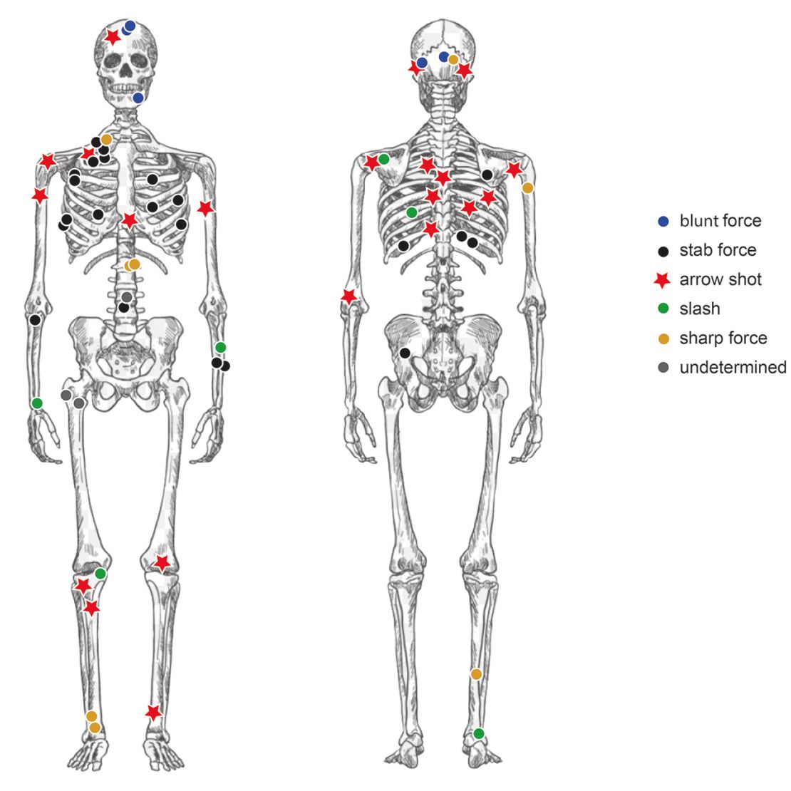 Researchers cataloged the types of injuries inflicted on remains recovered in the Tollense Valley to understand how the conflict played out.