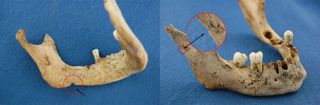 Two views of the jawbone that DNA analysis linked to James Fitzjames. Arrows illustrate cut marks consistent with cannibalism.