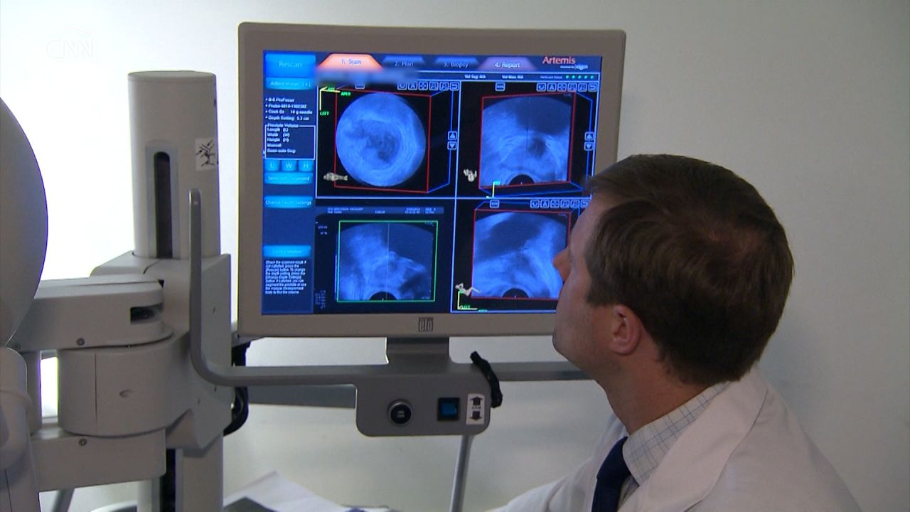 FSTHM CANCER PROSTATA.00_00_03_28.Still001.jpg