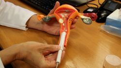 FSTHM TAMPON CANCER UTERINO.00_01_05_28.Still001.jpg