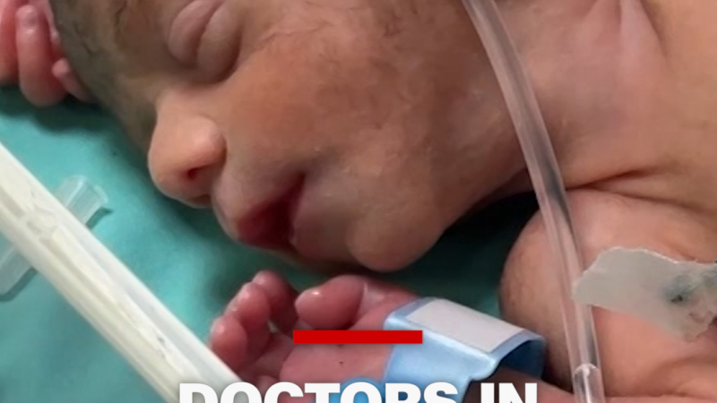 Doctors in Gaza struggle to keep babies alive