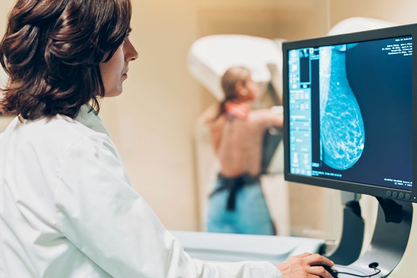 Starting mammogram screenings in midlife is essential to reduce risk of breast cancer death, a new study found.