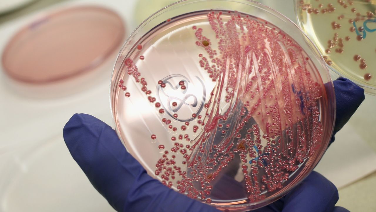 HAMBURG, - JUNE 02: A lab technician holds a bacteria culture that shows a positive infection of enterohemorrhagic E. coli, also known as the EHEC bacteria, from a patient at the University Medical Center Hamburg-Eppendorf on June 2, 2011 in Hamburg, . German health authorities are continung to grapple with the current outbreak of EHEC and claim that initial suspicions of cucumbers from Spain as being the source are unfounded, though they warn against consuming raw vegetables. The University Medical Center has the highest number of patients infected with EHEC as well as 102 patients who have come down with hemolytic-uremic syndrome (HUS), a complication that can lead to kidney failure, convulsions and epileptic seizures and is caused by EHEC. Authorites are reporting at least 2,000 cases of EHEC infection nationwide and at least 470 cases of HUS. Across Europe at least 17 people have died from the outbreak. (Photo by Sean Gallup/Getty Images)