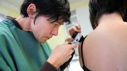 Une dermatologue observe à l'aide d'un dermatoscope un grain de beauté sur le dos d'une patiente, le 04 décembre 2008 à Quimper. Cinq critères, regroupés selon la méthode dite ABCDE (pour Asymétrie, Bords, Couleur, Dimension et Evolution", sont pris en compte pour évaluer la transformation d'un "naevus", le terme médical du grain de beauté, en mélanome. AFP PHOTO FRED TANNEAU (Photo by Fred TANNEAU / AFP) (Photo by FRED TANNEAU/AFP via Getty Images)