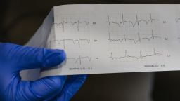 An emergency medical technician (EMT) reviews a patients EKG results in an ambulance in Joplin, Missouri, U.S., on Wednesday, Aug. 4, 2021.
