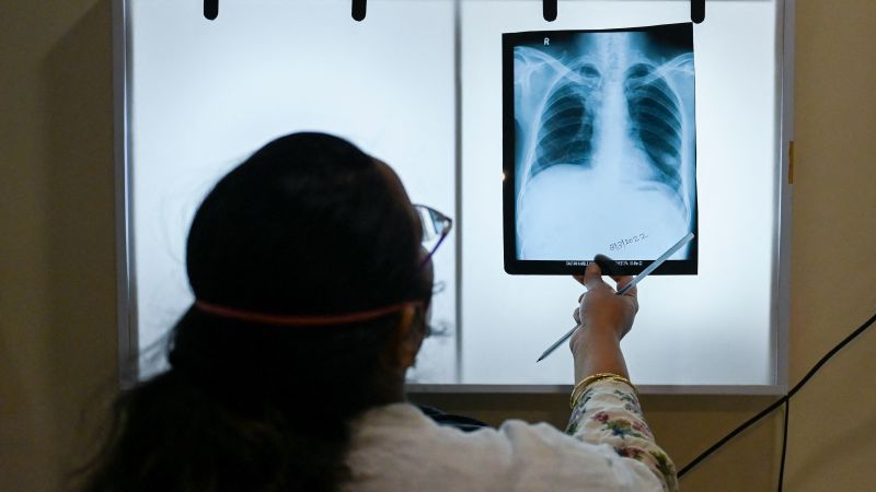 India vowed to eliminate TB by 2025 but its promise is unraveling under a national health care crisis