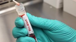 SEATTLE, WA - JULY 12: A swab that tested positive for the Monkeypox virus is seen at the UW Medicine Virology Laboratory at the UW Medicine Virology Laboratory on July 12, 2022 in Seattle, Washington. The UW Medicine Virology Laboratory is one of a handful of clinical reference labs in the country to offer laboratory-developed PCR tests for the detection of the Monkeypox virus.  (Photo by Karen Ducey/Getty Images)