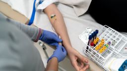 Nurse drawing blood sample from patient vein