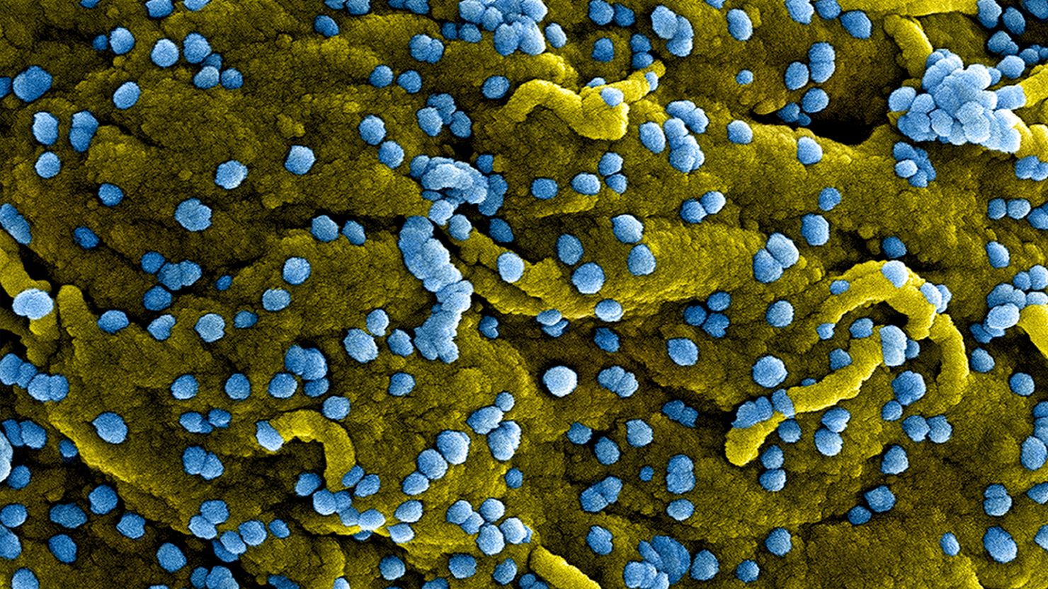 CDC will start screening travelers from Rwanda to the US for Marburg virus | CNN