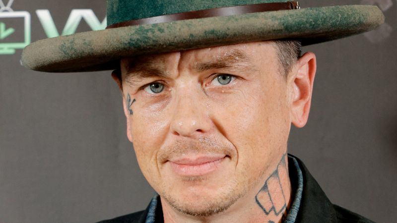 Slipknot member Sid Wilson suffers burns all over his body in accident