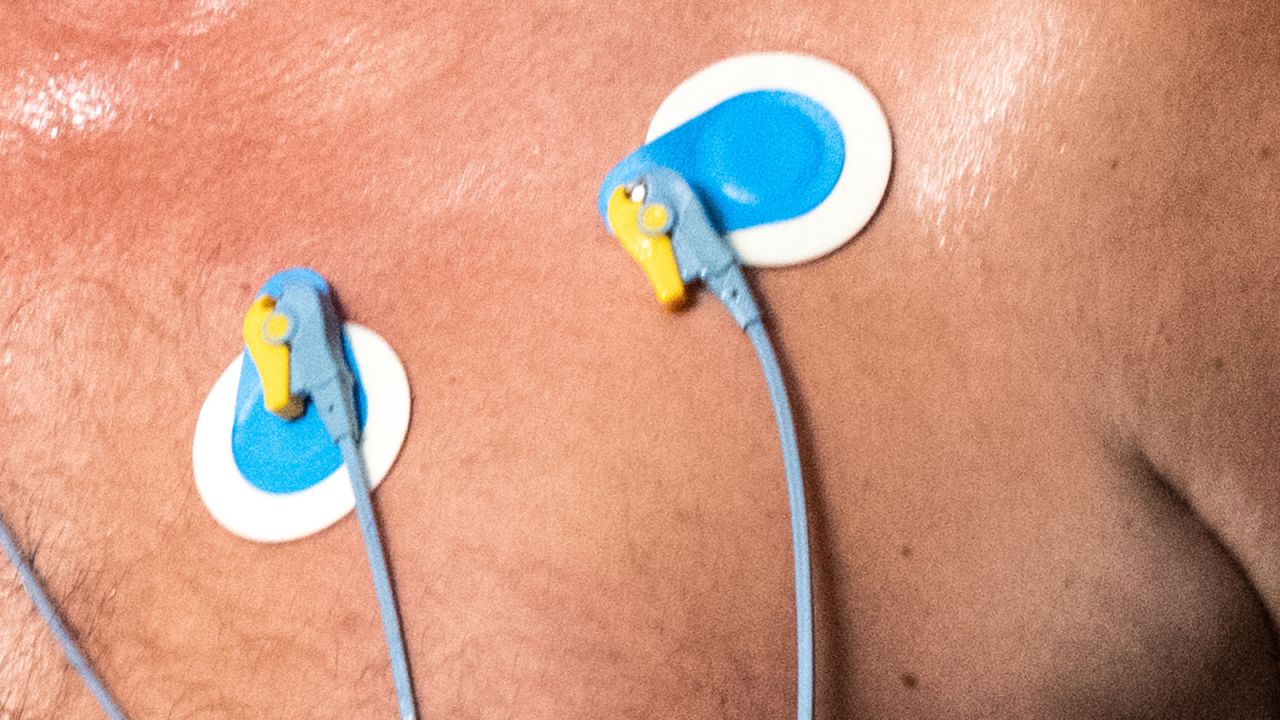 Leads placed on the chest during a cardiopulmonary stress test in clinic.