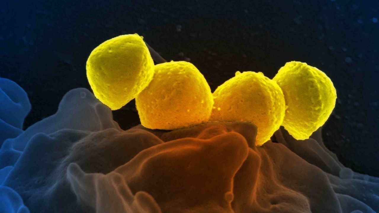 Scanning electron micrograph of Group A Streptococcus (Streptococcus pyogenes) bacteria on primary human neutrophil. (Photo by: IMAGE POINT FR/NIH/NIAID/Universal Images Group via Getty Images)