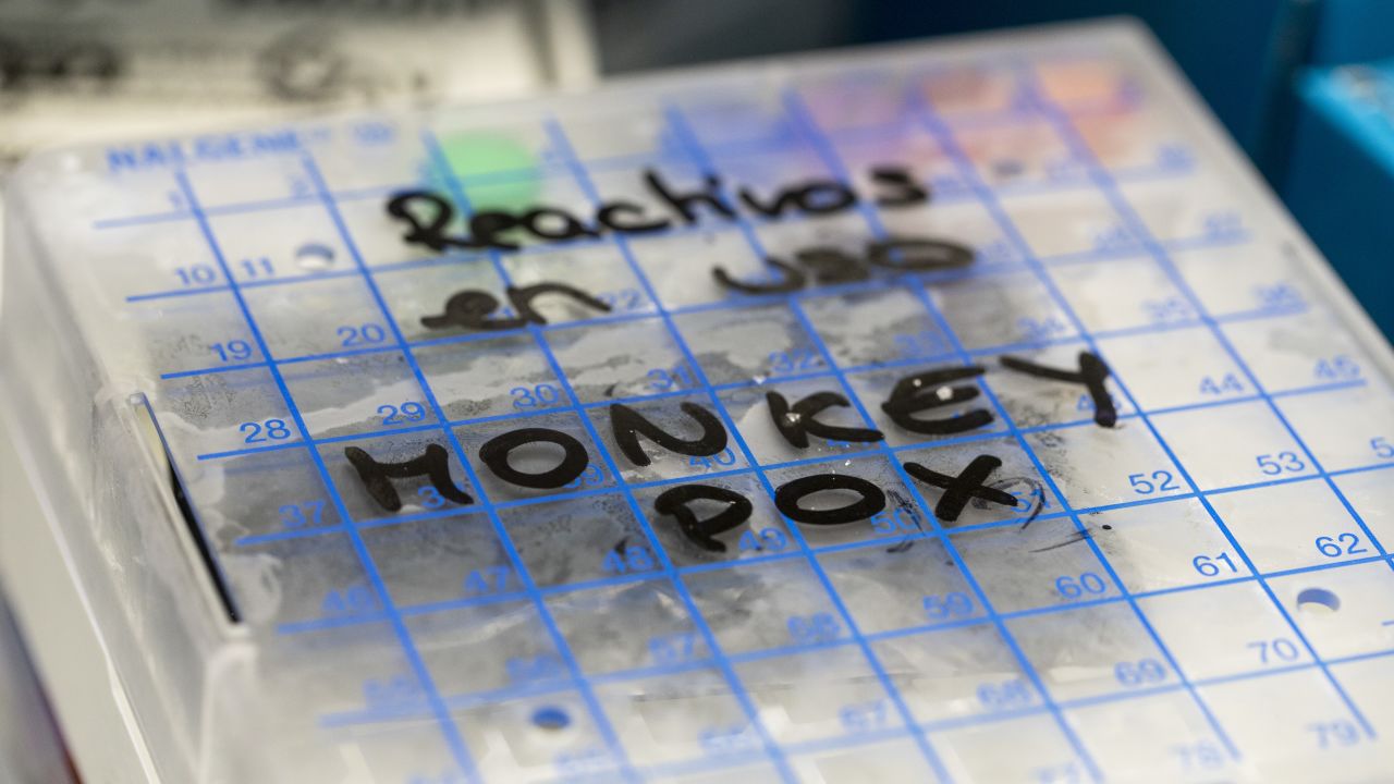 MADRID, SPAIN - JUNE 06: A reactive to test suspected monkeypox samples is seen inside a fridge at the microbiology laboratory of La Paz Hospital on June 06, 2022 in Madrid, Spain. Europe is at the centre of the monkeypox virus outbreak, the World Health Organisation reported 780 confirmed cases with Britain, Spain and Portugal reporting the largest numbers of patients. (Photo by Pablo Blazquez Dominguez/Getty Images)